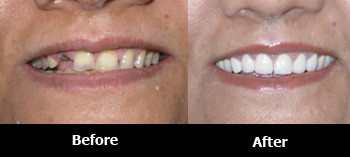 Cosmetic Dentistry