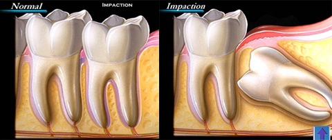 Surgical Treatments