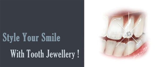 dental jewellery