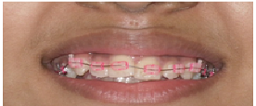 orthodontic